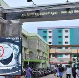 தவறி விழுந்த இளம்பெண்.. தரையில் கிடந்த ஊசி இதயம் வரை புகுந்ததால் அதிர்ச்சி