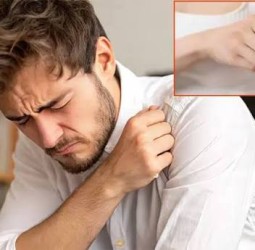 வியர்க்குருவை விரட்ட 10 எளிய வழிமுறைகள்