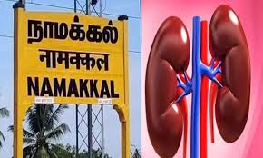 நாமக்கல் கிட்னி விற்பனை புகார்: தானமாக வழங்கியவர், பெற்றவர்களிடம் சிறப்பு குழு விசாரணை