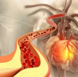 உடலில் கெட்ட கொழுப்பு அதிகரித்தால் இந்த உறுப்புகள் எச்சரிக்கை செய்யும்