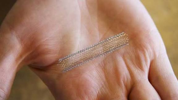 இந்தியாவில் தயாரிக்கப்பட்ட புதிய தலைமுறை இதய ஸ்டென்ட்டுக்கு உலகளாவிய அங்கீகாரம் கிடைத்துள்ளது