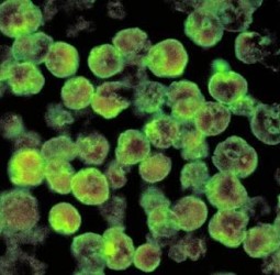 கேரளாவில் அமீபா தொற்று: உயிரிழப்பு 6 ஆக உயர்வு