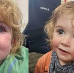 முத்தத்தால் குழந்தைக்கு கண் பார்வை பறிபோன பரிதாபம்