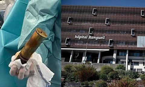 ஆசன வாயில் வெடிகுண்டுடன் வந்த நபர்..பயத்தில் அலறி அடித்து ஓடிய நோயாளிகள்