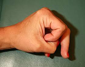 விரல் முறிந்த கவிஞன்